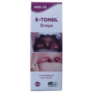 Homeopathy for Tonsillitis Treatment