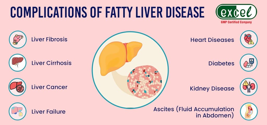 Homeopathic Medicines for Fatty Liver Treatment with Best Results